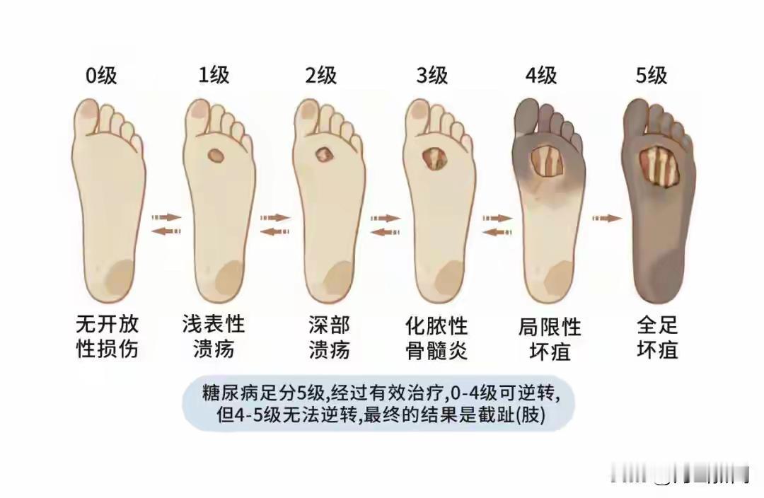 “我才106斤，不爱喝奶茶，不点外卖，怎么就得糖尿病了？”河南一研究生小王感觉恶