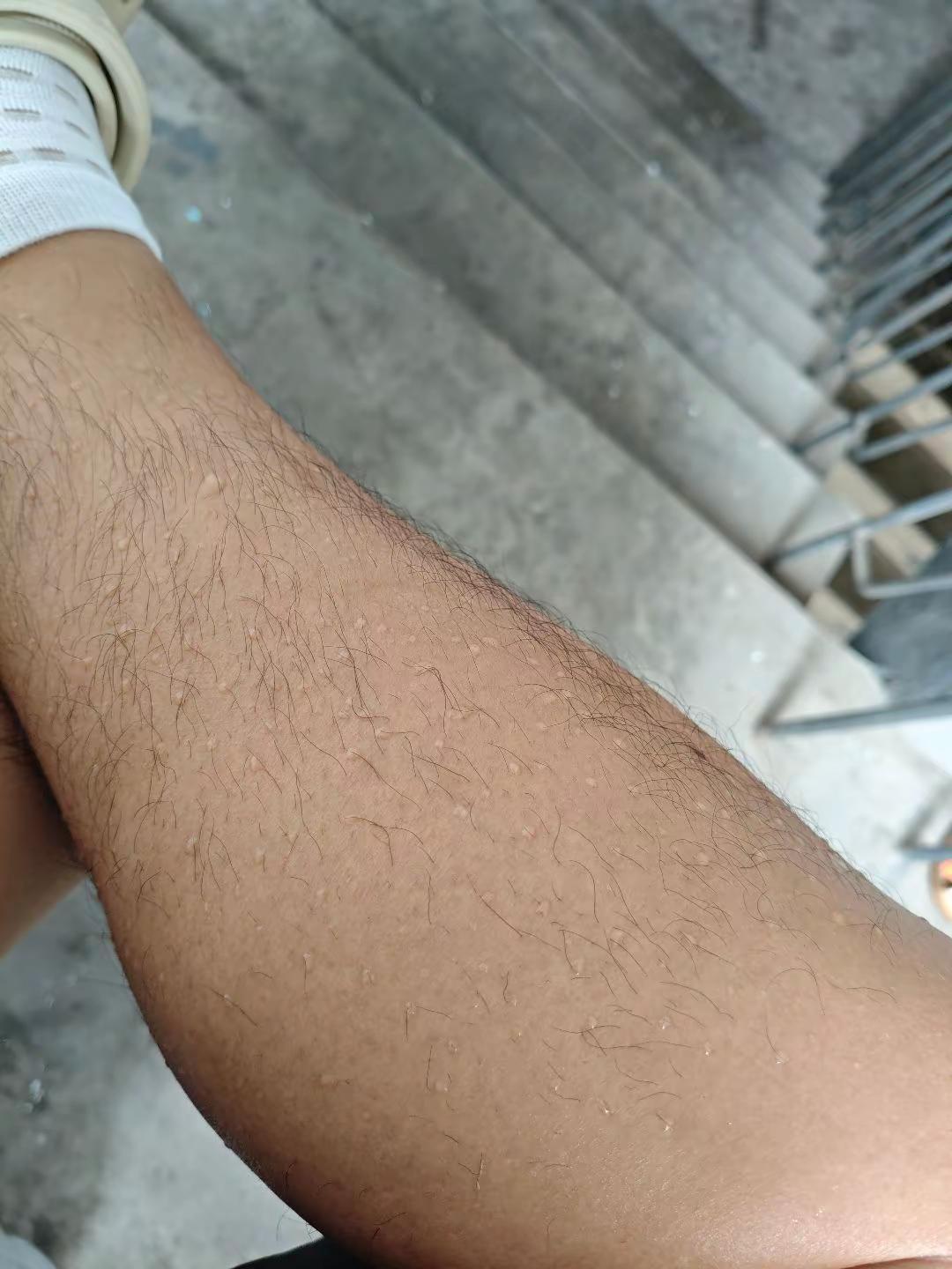 汗毛多的好处