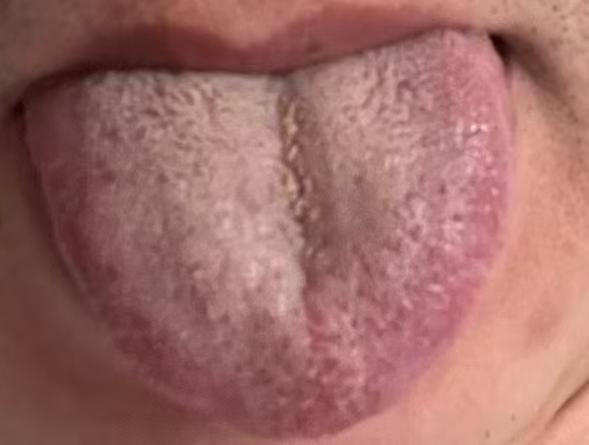 肝肾精气耗损容易影响身体机能，从滋养肝肾入手，科学调养海绵体健康






很
