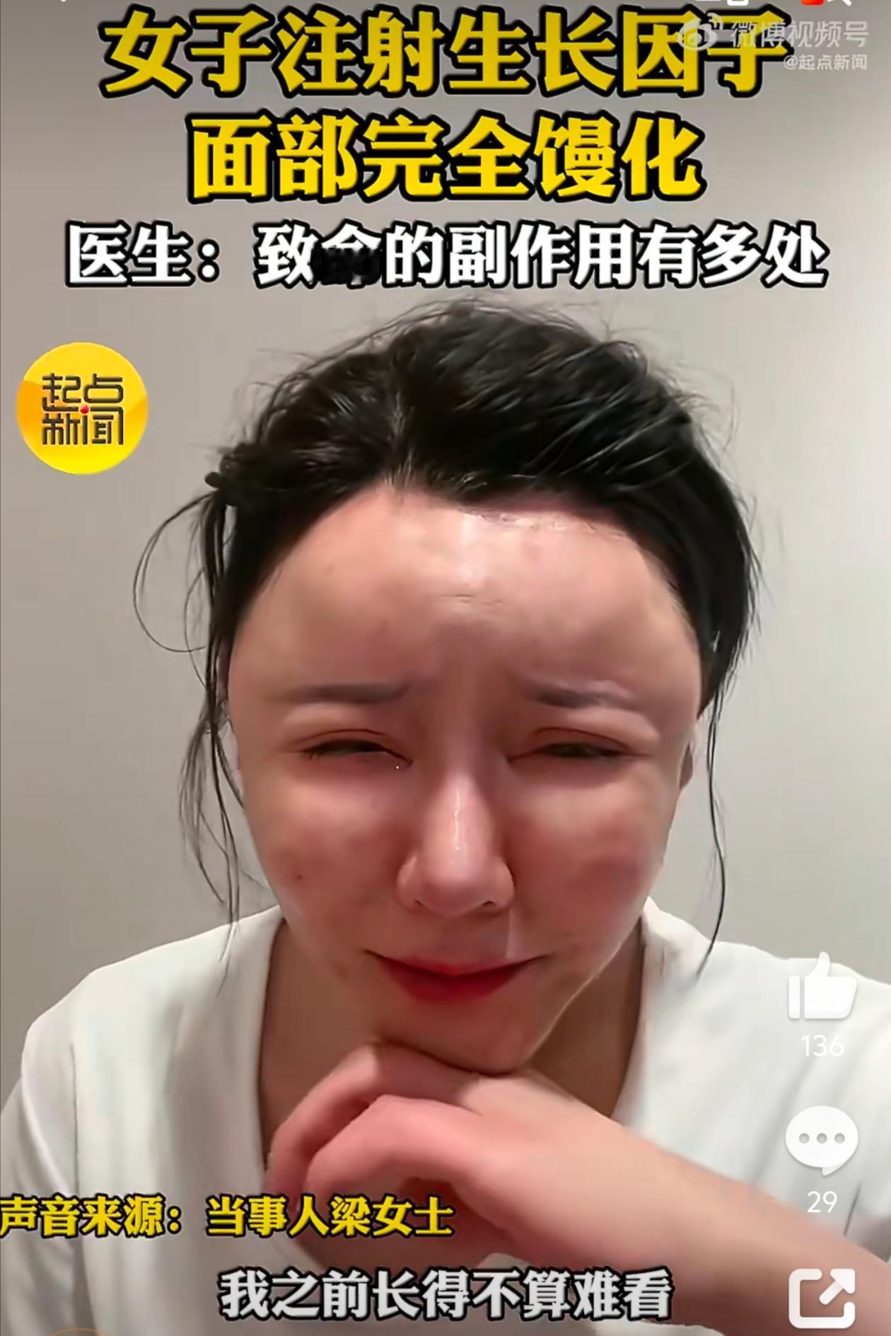 女子过度医美面部馒化酷似面具人这东西居然是“明文禁止”的！新闻里医生说得明明白白