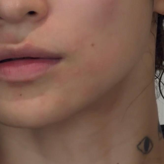 只是被freya抓了一下脖子 结果整张脸过敏了  我什么时候能对猫脱敏 