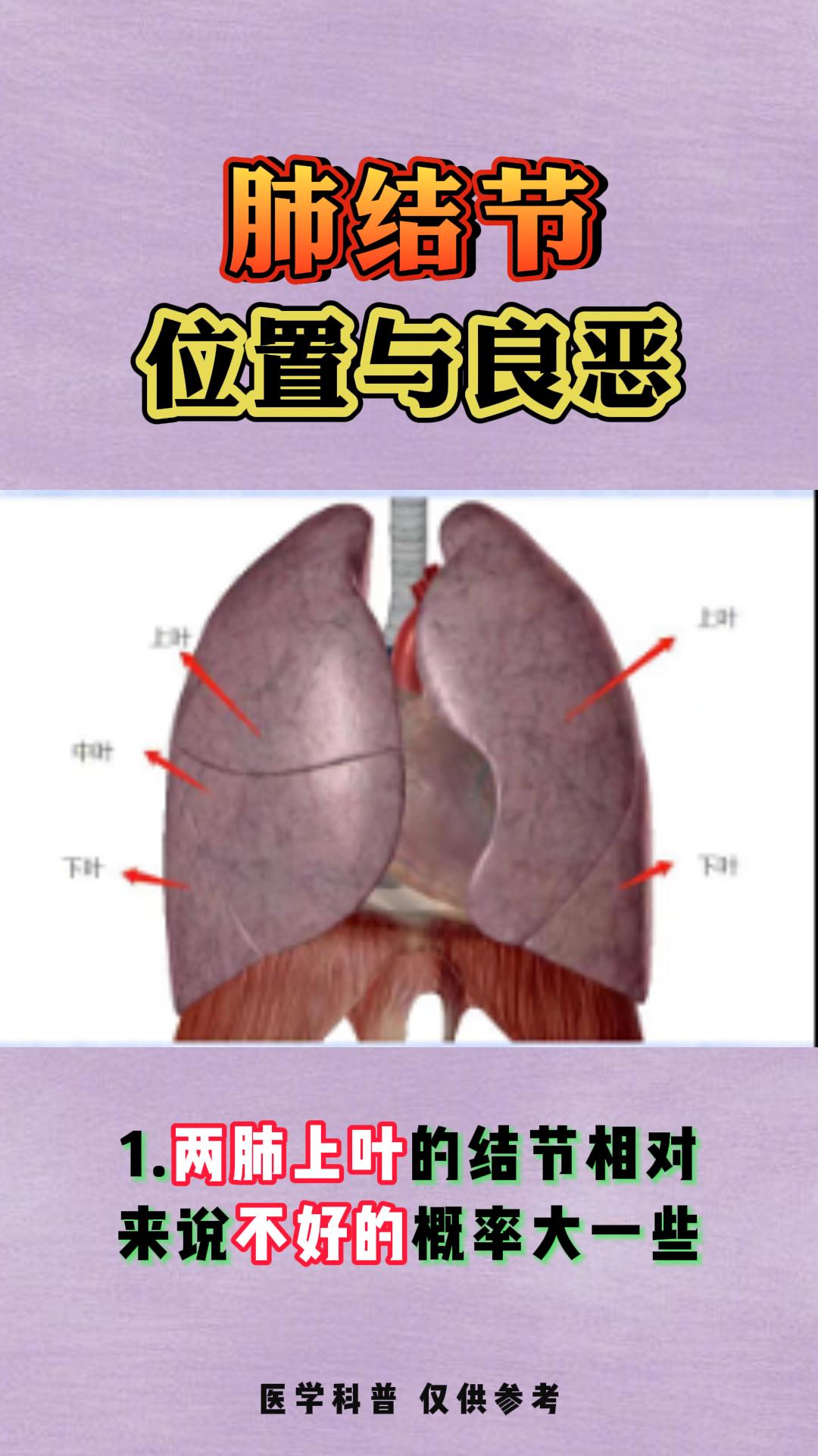 肺结节的位置与良恶。