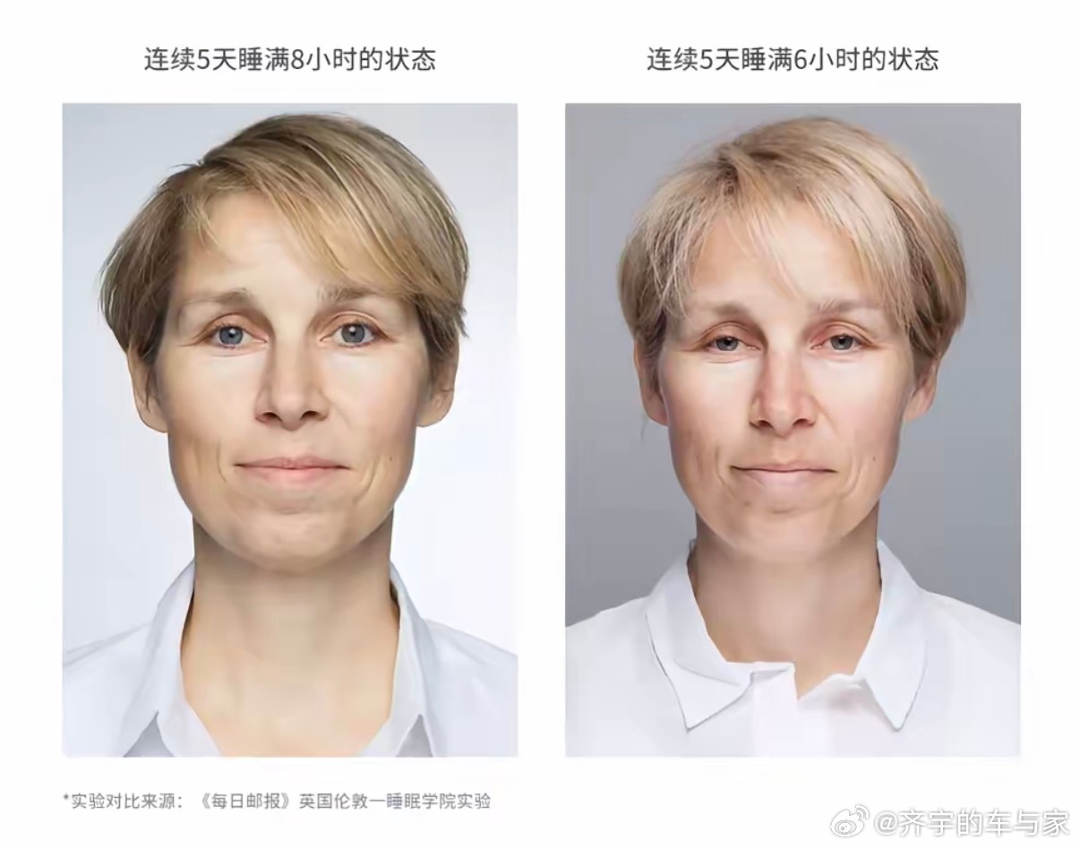 熬夜的危害会让人脑子变慢、眼神迷离，大家晚上几点睡呢？女子熬夜3个月突然开始对墙