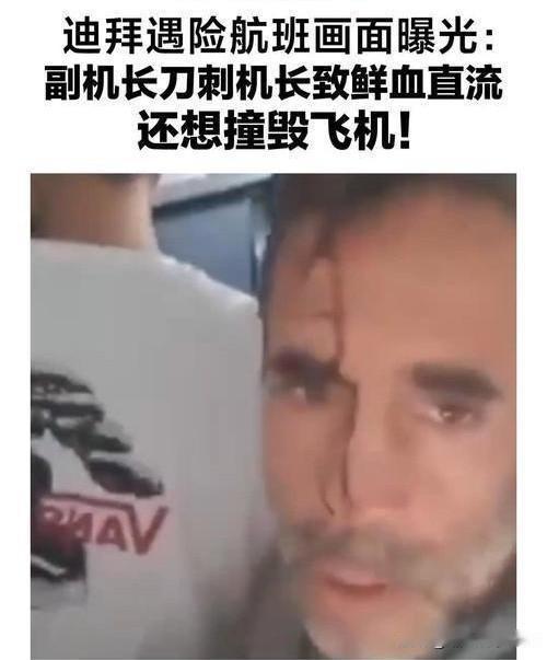 蹊跷万分的迪拜航班遇袭事件

一架阿联酋迪拜航空公司的飞机，在飞往以色列特拉维夫