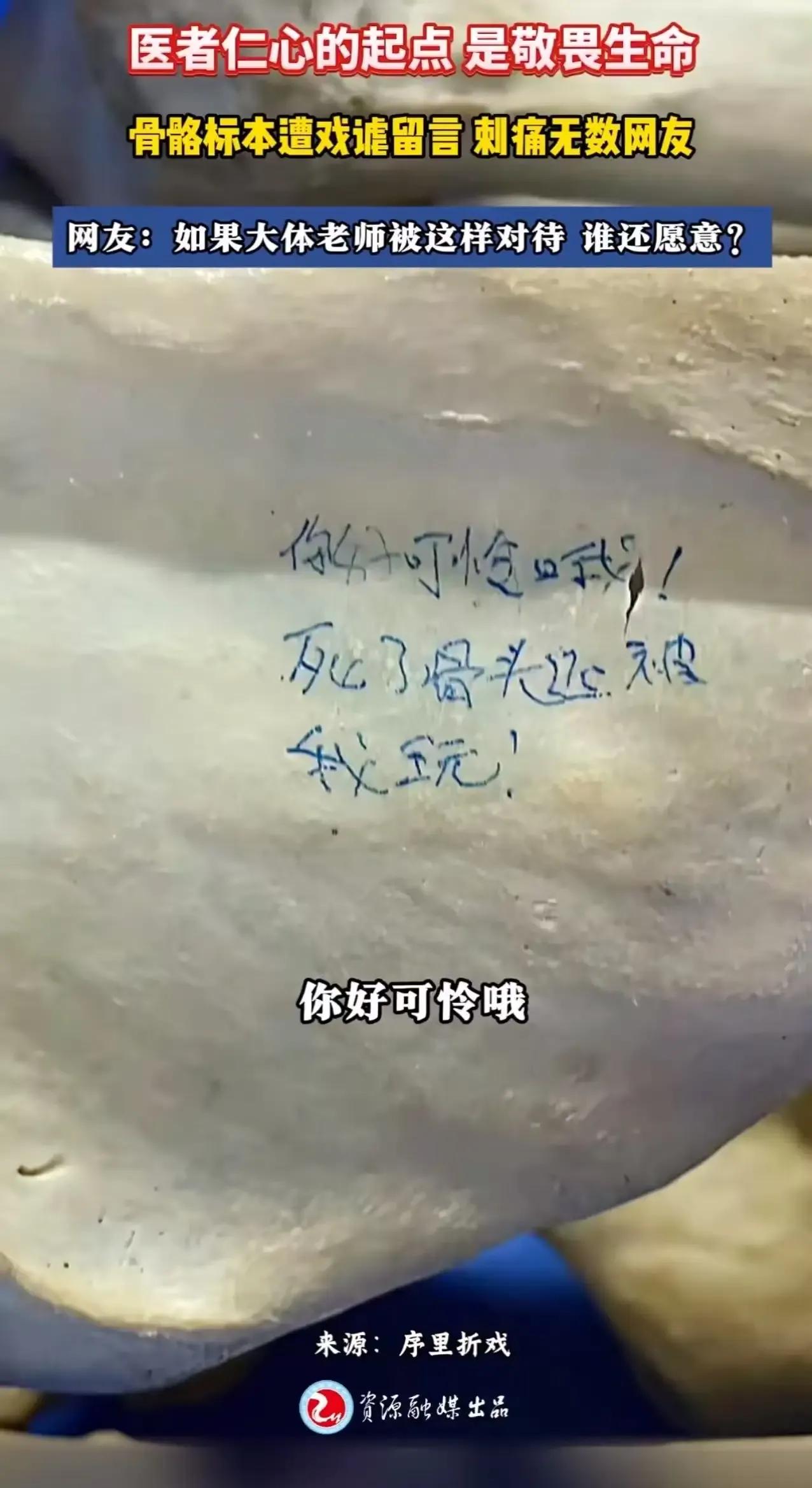 当“医者仁心”遇上“骨骼涂鸦”，你猜网友炸没炸？医学生竟在标本上写下“你好可怜哦