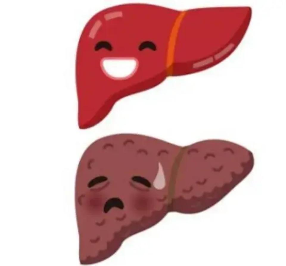 养肝护肝，只需做好以下五件事养护肝脏并不难，只要做到以下五件事就可以。·第一，养