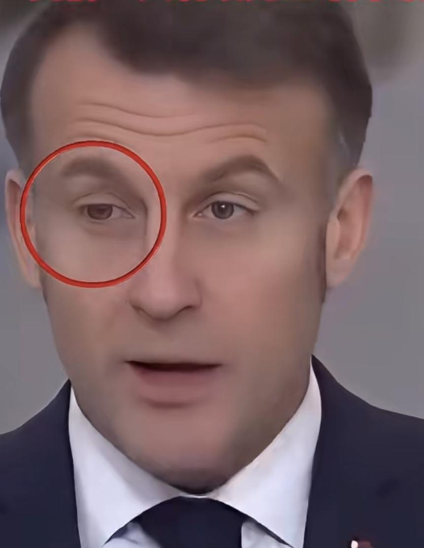 小马哥疑被家暴！1月15日，他向军队新年致辞时右眼充血，引发大家关注。1月16日