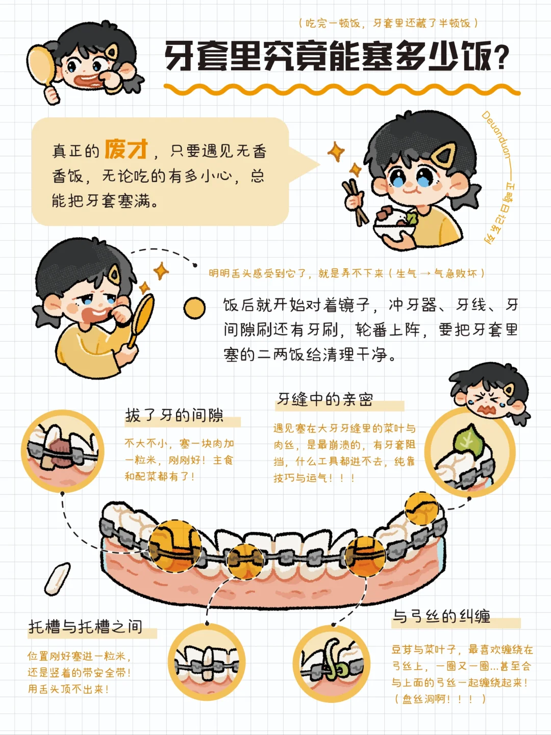 废才的正畸日记5｜牙套里究竟能藏多少饭？