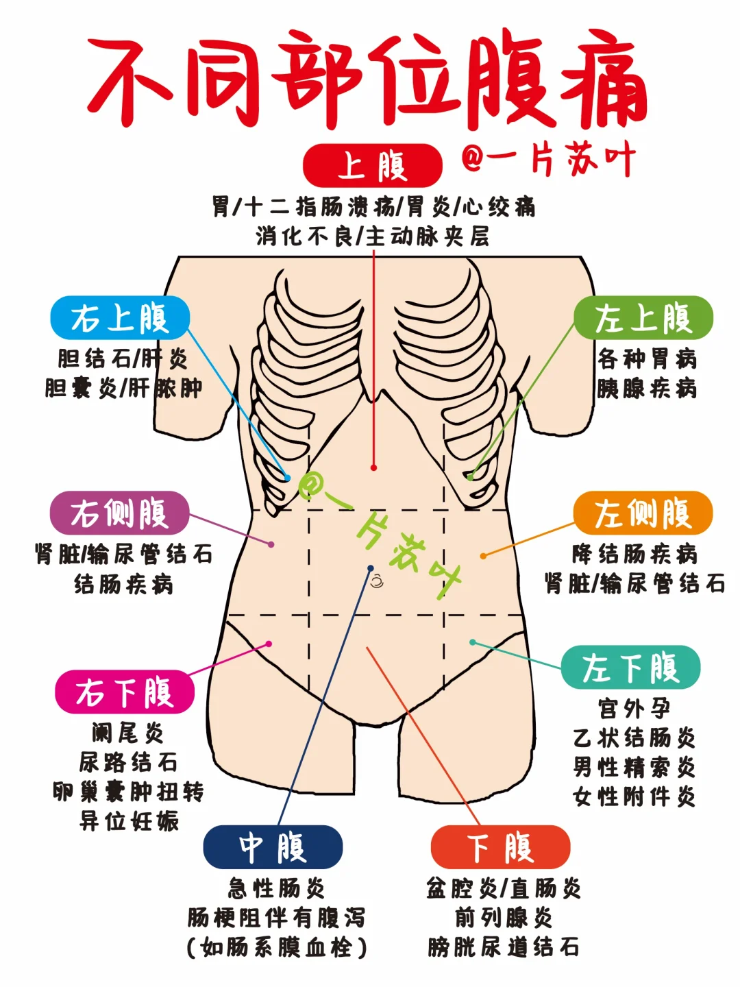 手写笔记✅一张图轻松区分“腹痛”‼️
