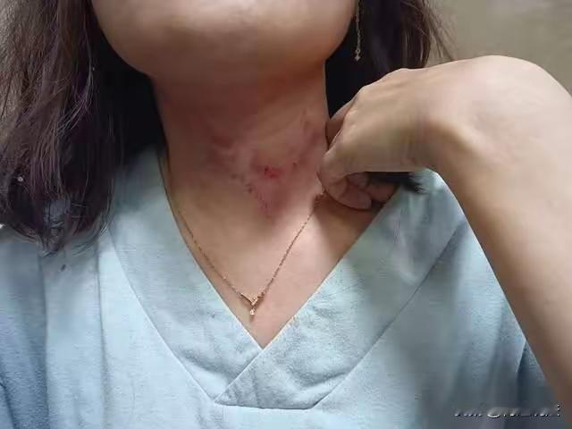 女子应约拿还款遭非礼 路人拍视频吓跑施暴者：四川广汉30岁的薛芯借750元给男性
