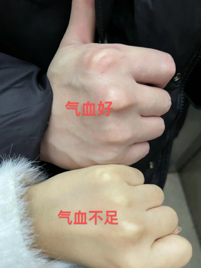 怎样补气血补最有效？ 