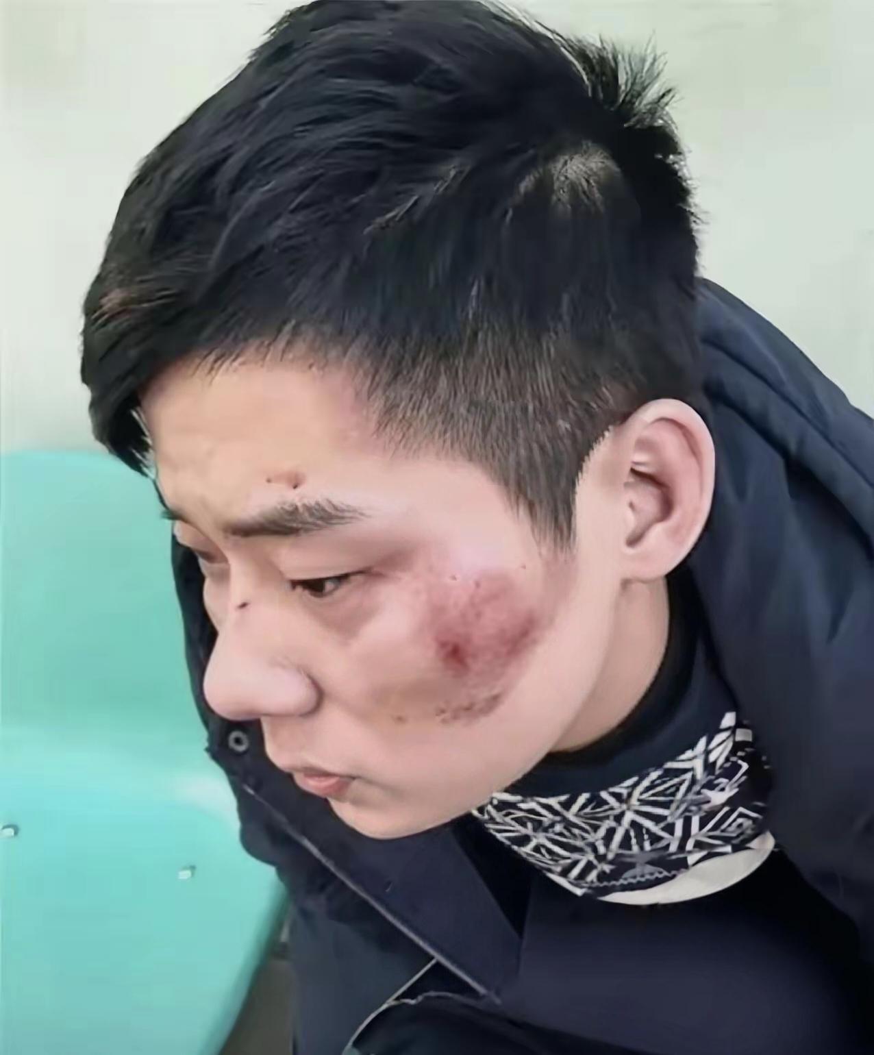 凌晨的四川广元，一名男子被多人追打，慌不择路直奔武警营门自卫哨求救。
 
生死关