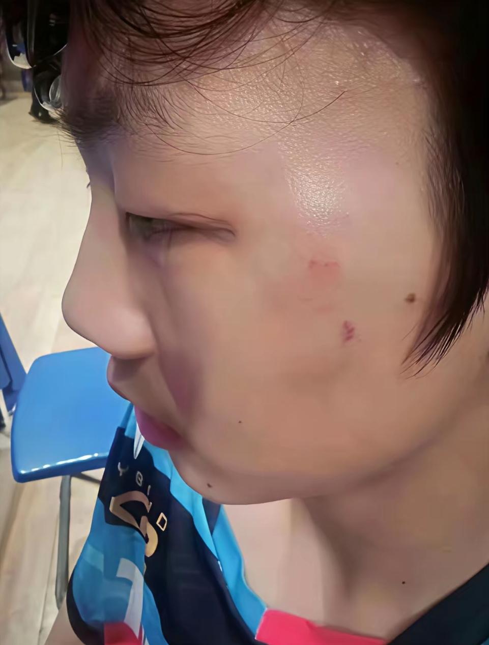 把人脸都打肿了仅仅只是禁赛一年？现在的犯罪成本这么低吗？根据相关法律打人者至少要