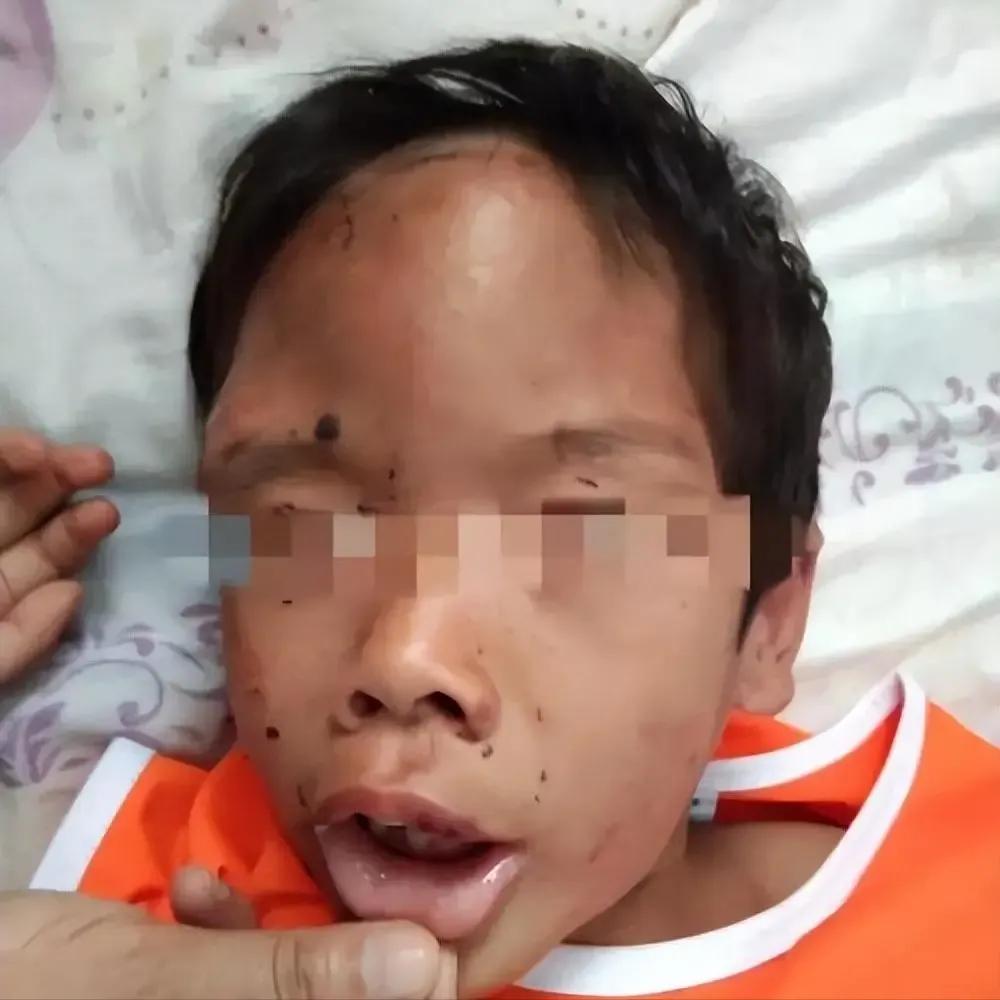 记住这个幼儿园，天水市麦积区培心幼儿园；
记住这个幼儿园251名孩子233名铅中