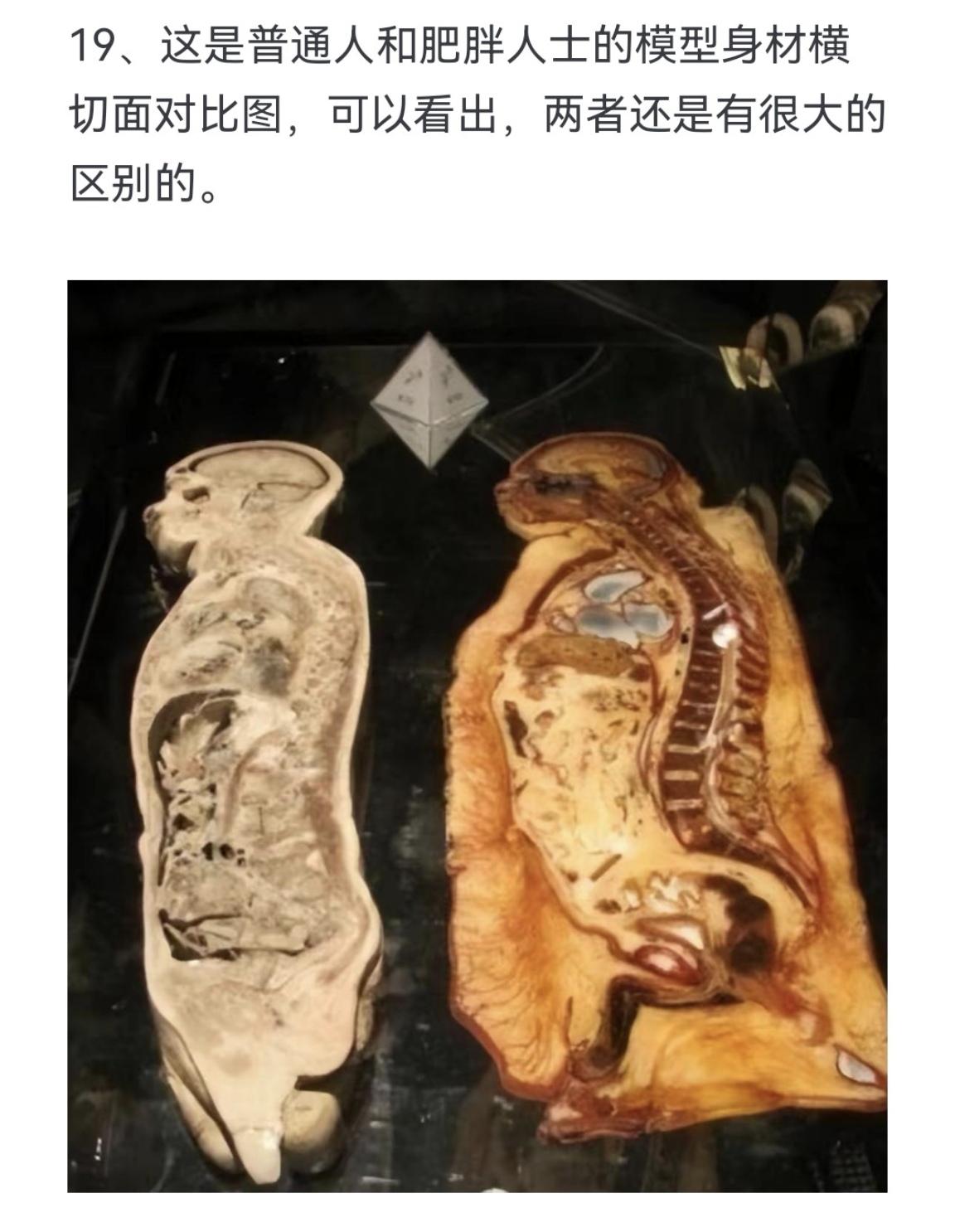 这是普通人和肥胖人士的模型身材横切面对比图，可以看出，两者还是有很大的区别的。