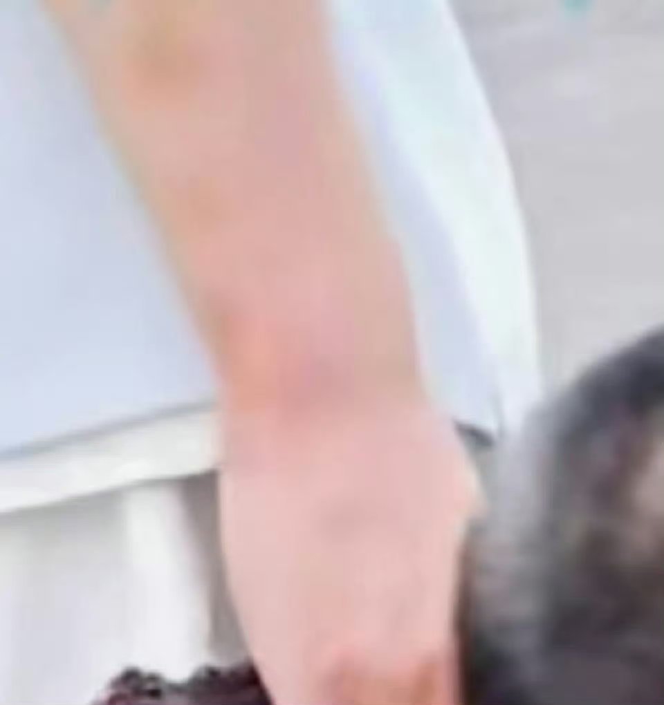 杨洋手部又受伤了不止粉丝，路人看到杨洋的手都觉得心疼……剧组还是干点人事儿吧 