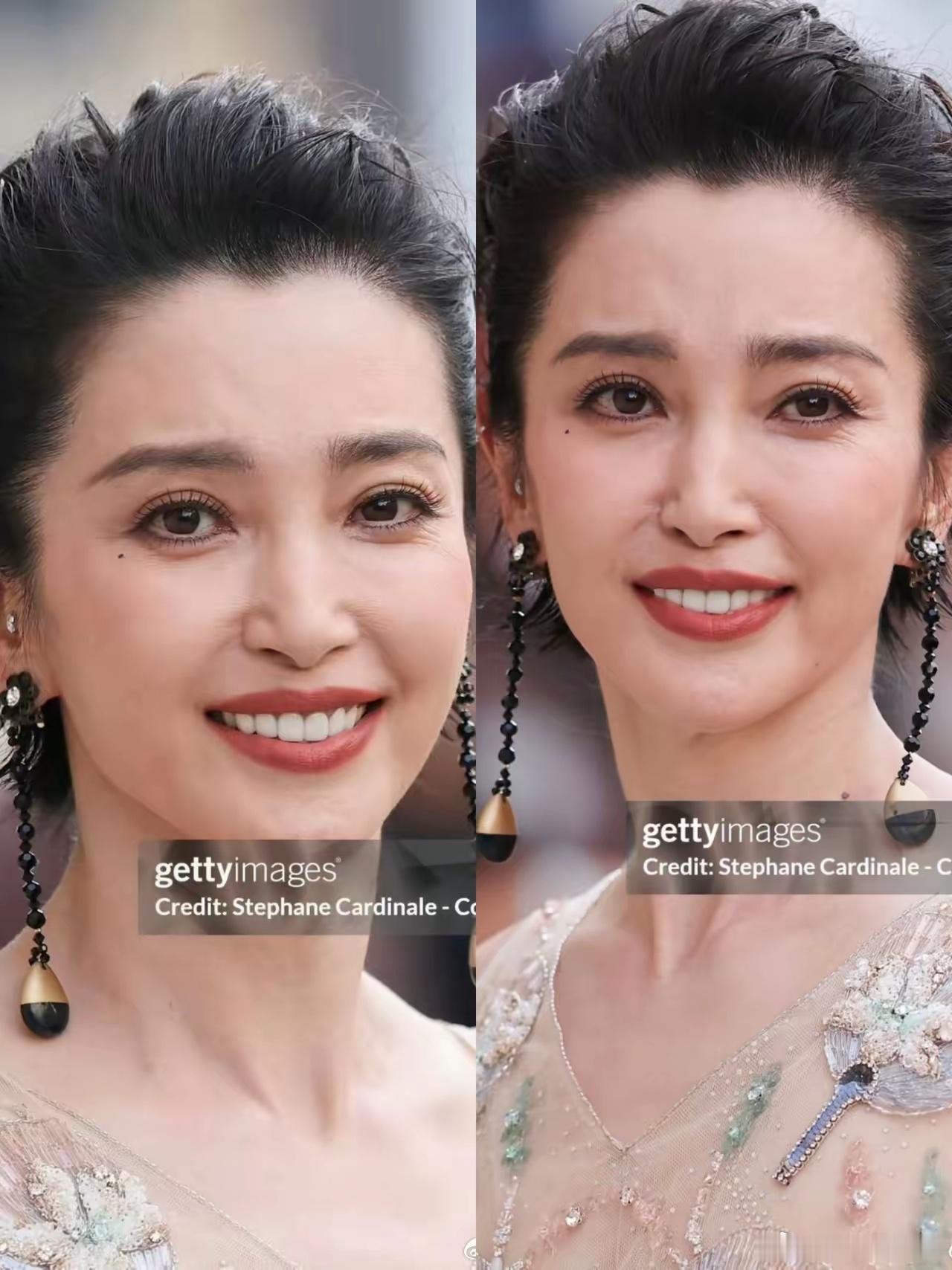我有个做医美的朋友说，李冰冰这张图一看就不是演出来的，人的表情肌是联动的，真想半