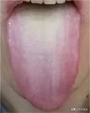 这位患者主诉，平时办事能力很差，上场即泄，还伴有大腿根潮湿的情况，自认为是肾不好
