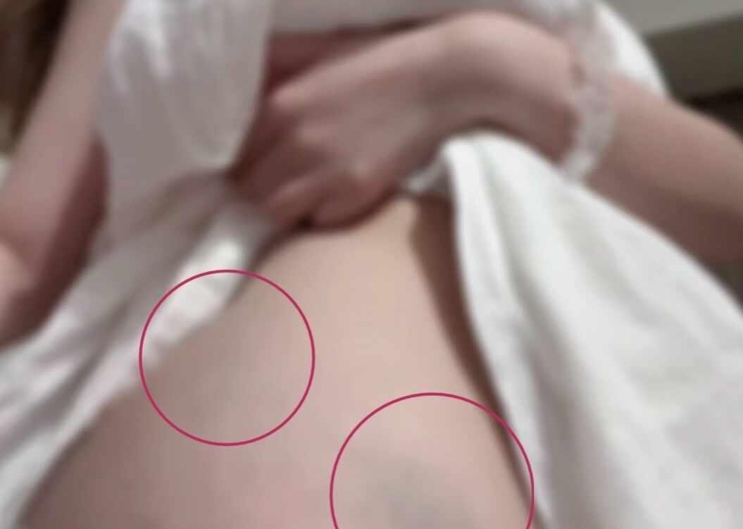 我房间的门克我。😇
回来就撞了两个巨大淤青，我不明白为何会上当两次，超级痛，类