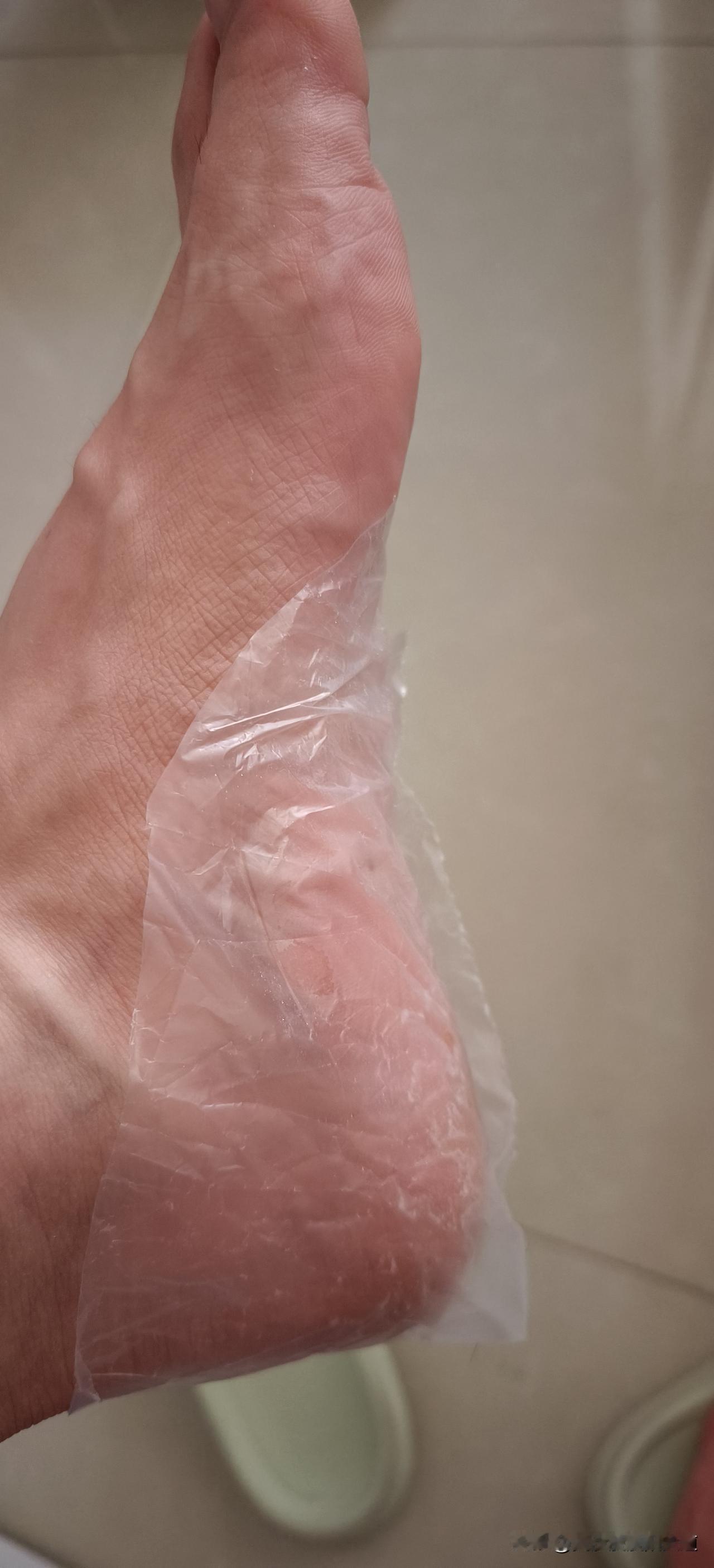 如此不间断的方式将伴随老汉余生了……