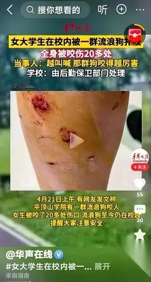 流浪狗咬人了

爱狗人士去哪了

为啥当初闹得沸沸扬扬，现在全成了哑巴？

两年