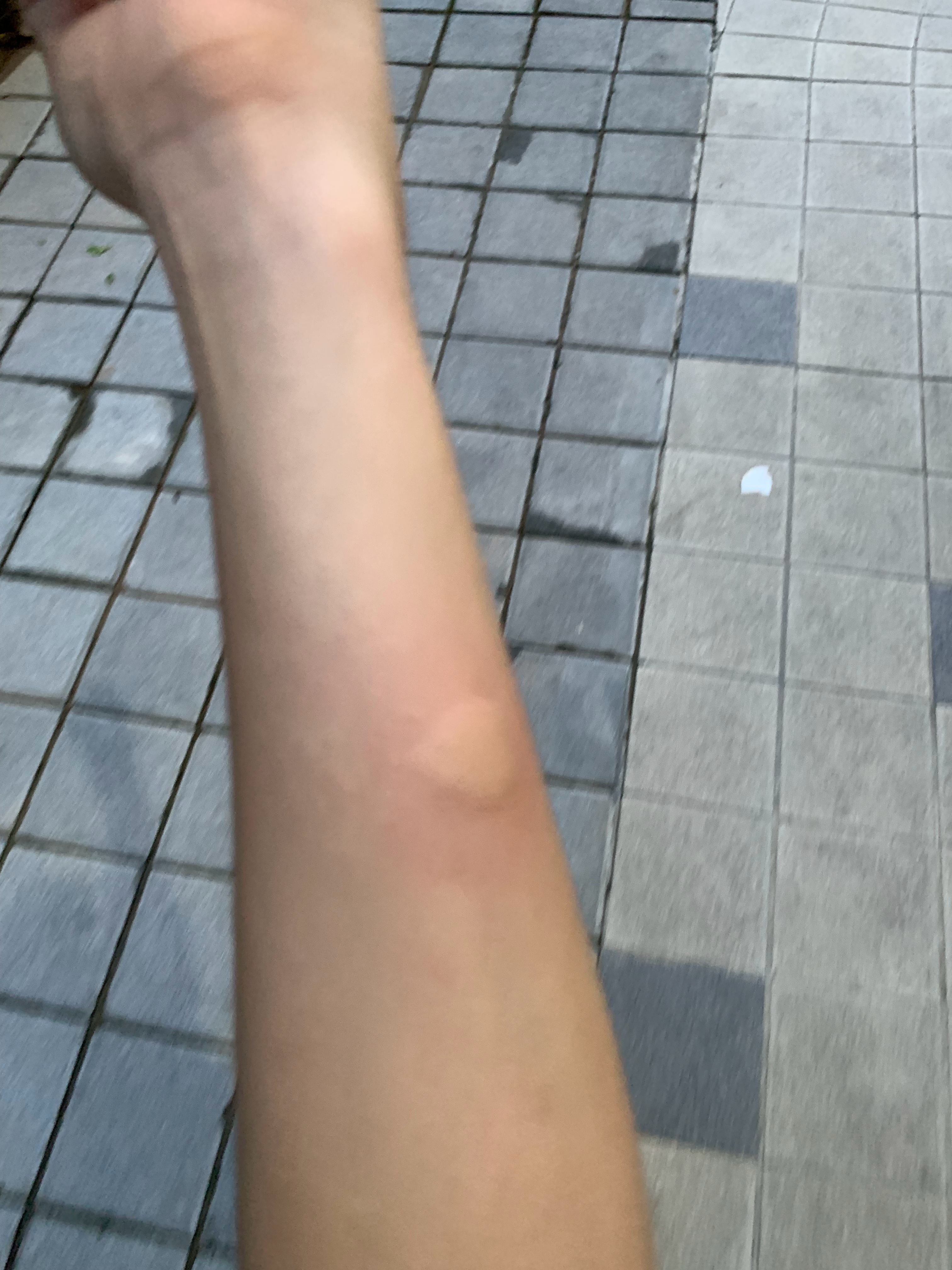 什么鸟虫。杀伤力这么强 