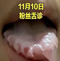 关键时刻掉链子，以为只是太累了？
白天哈欠连天，晚上翻来覆去睡不着。
腰酸、肚子