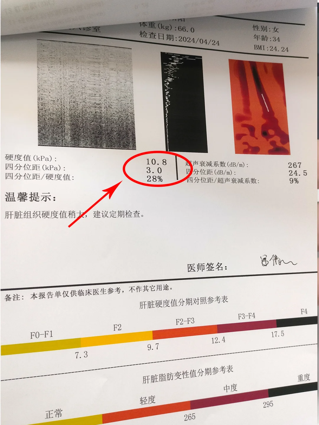 又是一位被耽误的34岁乙肝患者，老观念害人