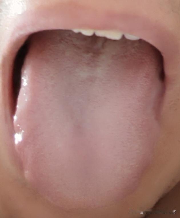 都40的人了，身体“造”成这样，这种情况还乱补，后半辈子是不准备过了？[what