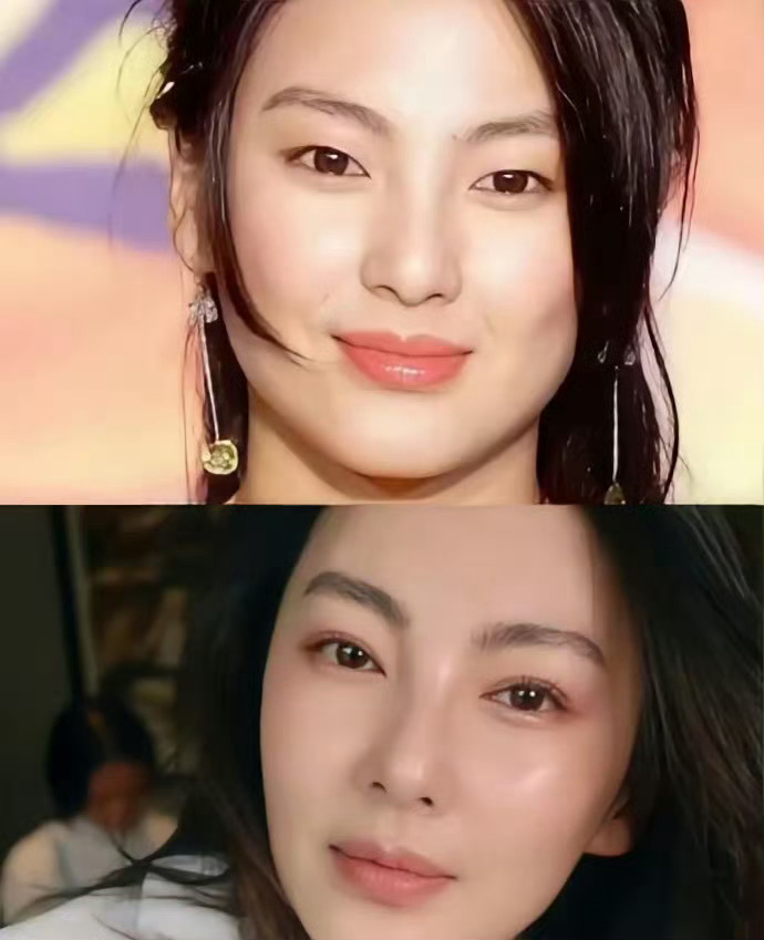 张雨绮这个双眼皮确实是做得成功了 