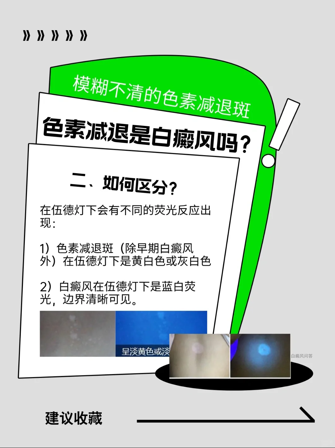 色素减退就是白癜风❓这白斑不都是白癜风