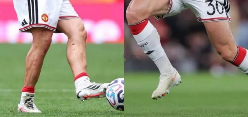 The Athletic指出，如今英超球员的护腿板小得难以想象能防护什么，一些现