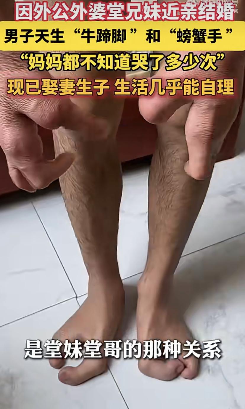 最近网上有个事挺触动人的。安徽一位大哥，手脚天生有些畸形。他说是因为自己外公外婆