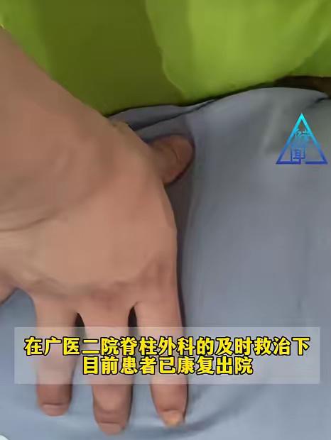 睡了一觉，30岁男子醒来双下肢瘫痪、大小便失禁，竟因前一晚200多斤的他为缓解酸