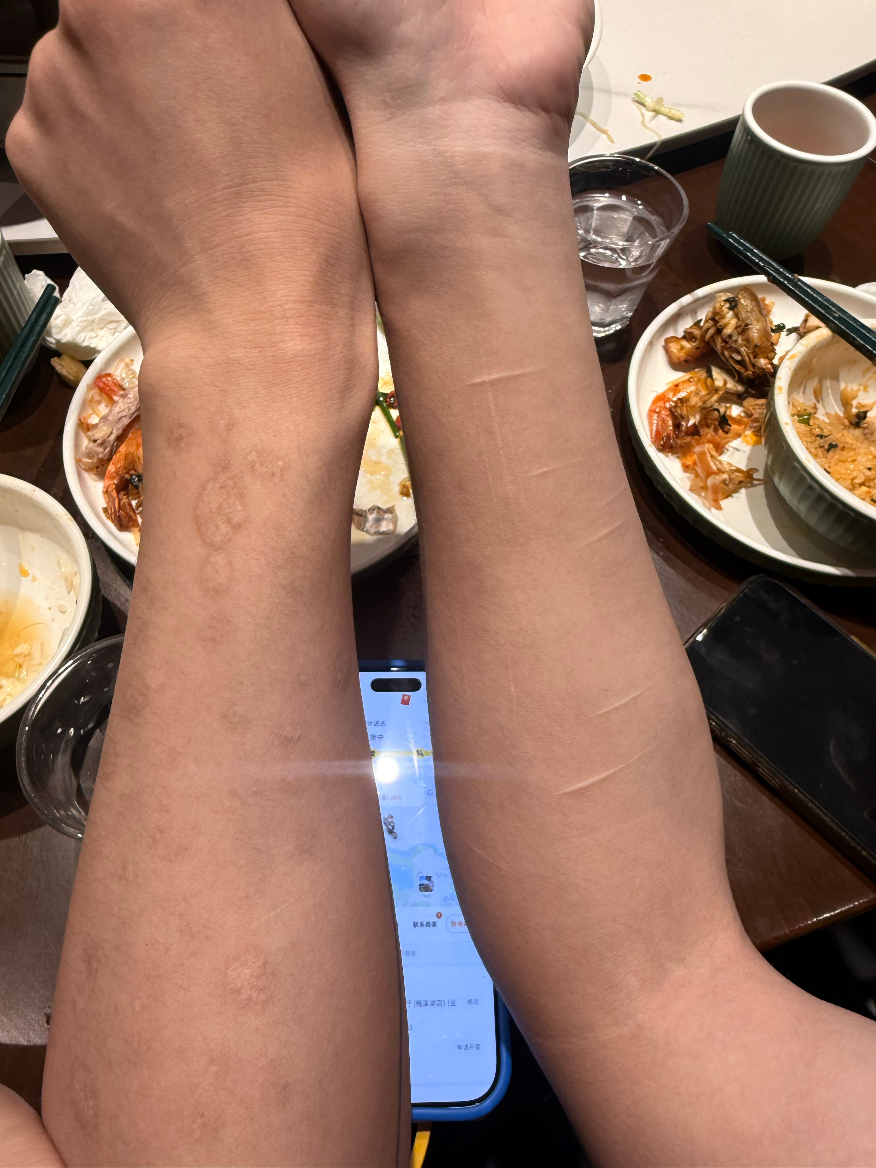 一个烟头疤一个刀疤 他们是一对😃 ​​​
