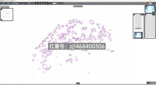 类器官病理持续进行