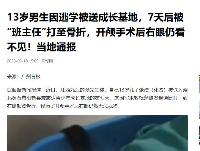 灭绝人性！5 月 19 日，江西本地媒体曝光，一起封闭特训营的恶性暴力事件震惊全