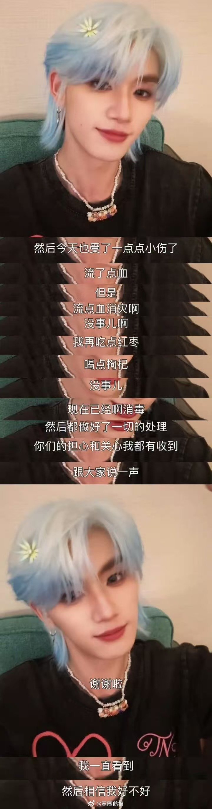丁程鑫回应手流血丁程鑫手处理好了丁程鑫啊啊啊啊 