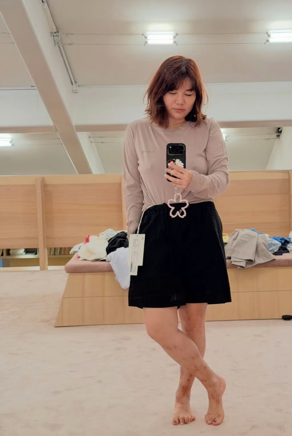 杨天真晒腿被跳蚤咬伤聊天时杨天真主动撩开裤腿、抬起手臂露出成片叮咬印记，坦言瘙痒