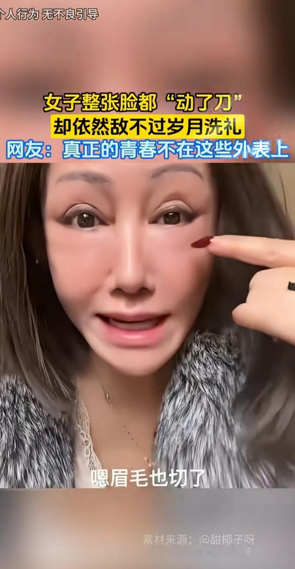 女子想保持年轻漂亮，切了眉毛，做了眼袋，拉皮三次，连嘴巴也整了。
戴上假发，貂也