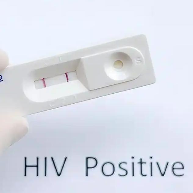 北京佑安医院感染中心门诊主任医师李在村曾接诊一名80多岁的男性HIV感染者，感染