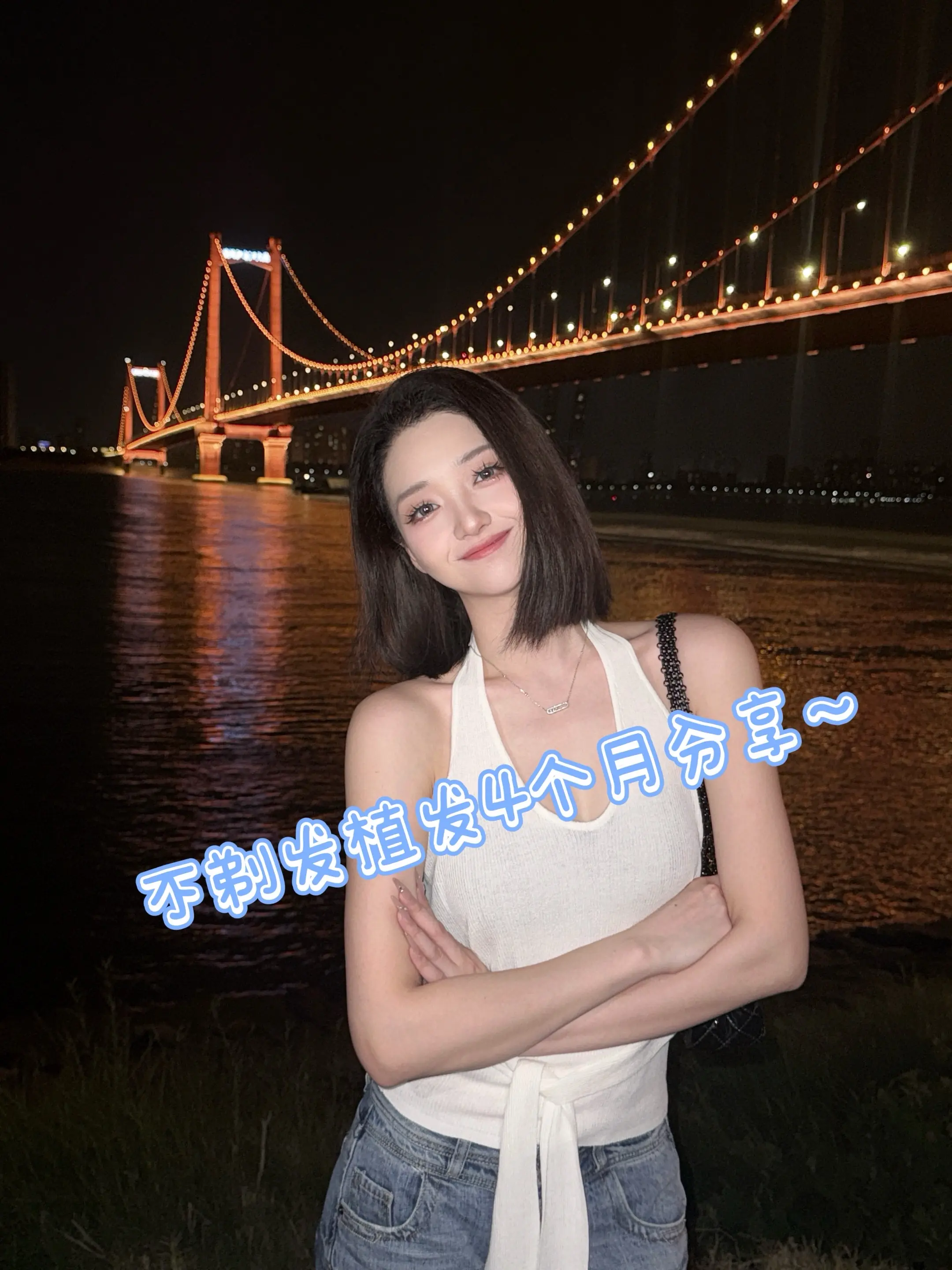不剃发植发四个月分享～