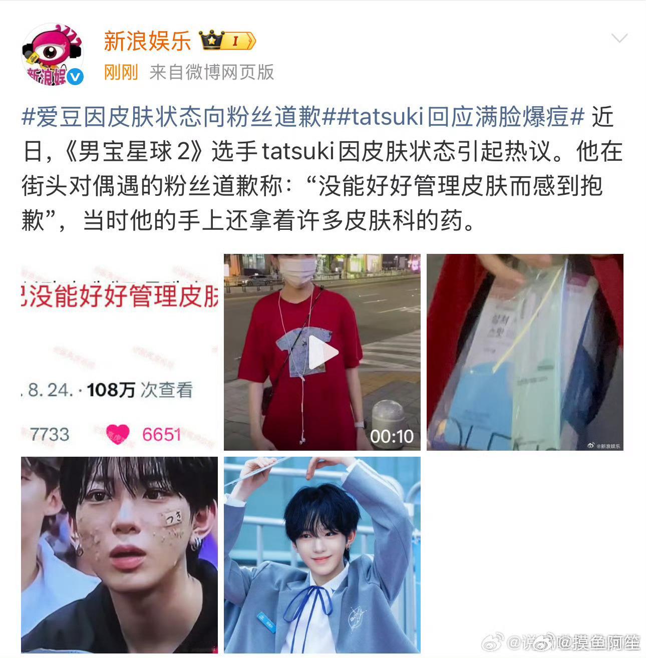 倒霉就倒霉在人生最需要展现颜值的时候突然长痘[允悲]是不是被其他选手下药了啊男宝