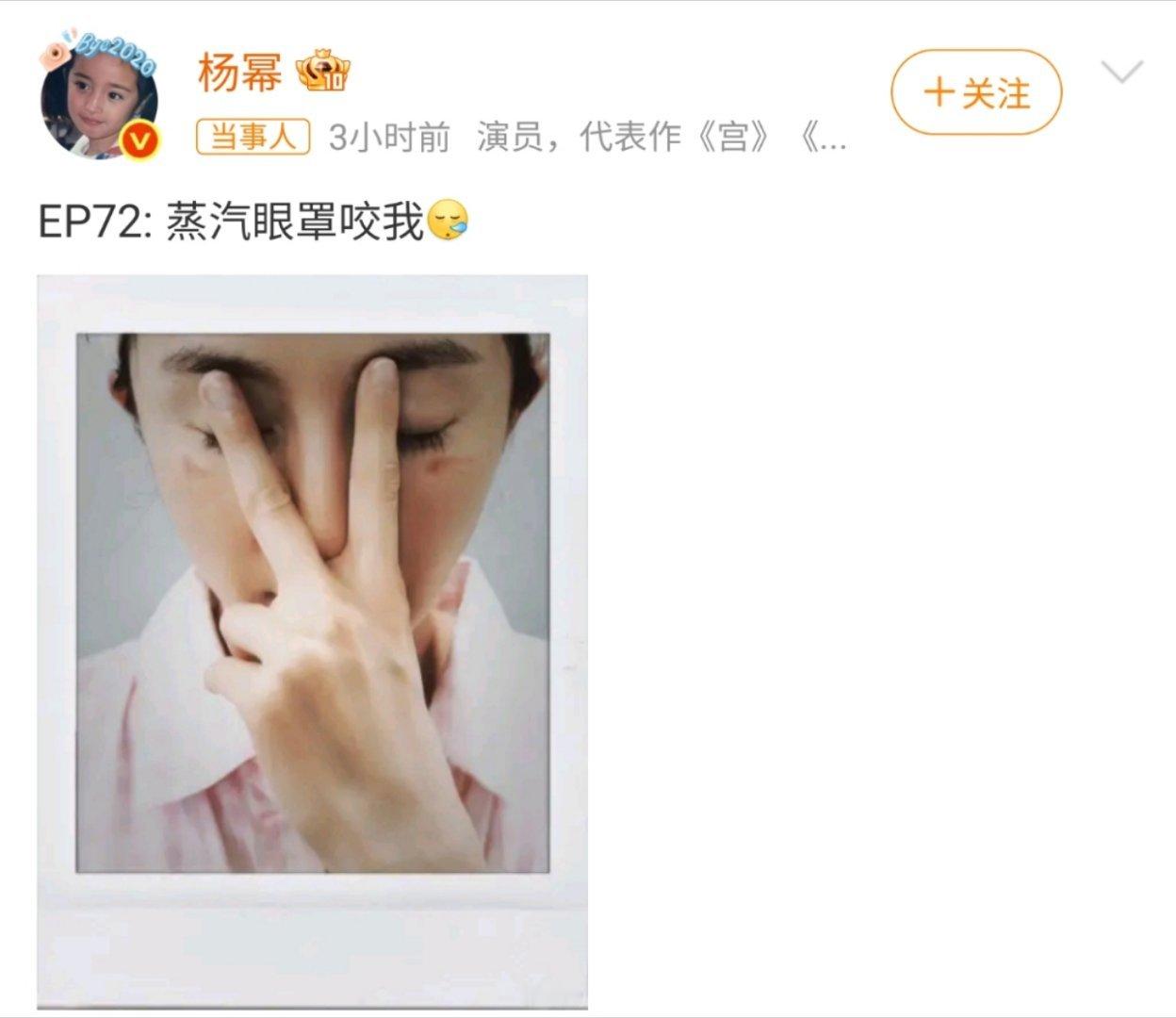 医生回应杨幂脸被蒸汽眼罩烫伤太认同医生的提醒了。很多人以为不烫手就没事，其实眼周