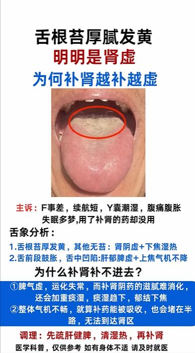 舌根苔厚腻发黄，明明是肾虚，为何却越补越虚呢？