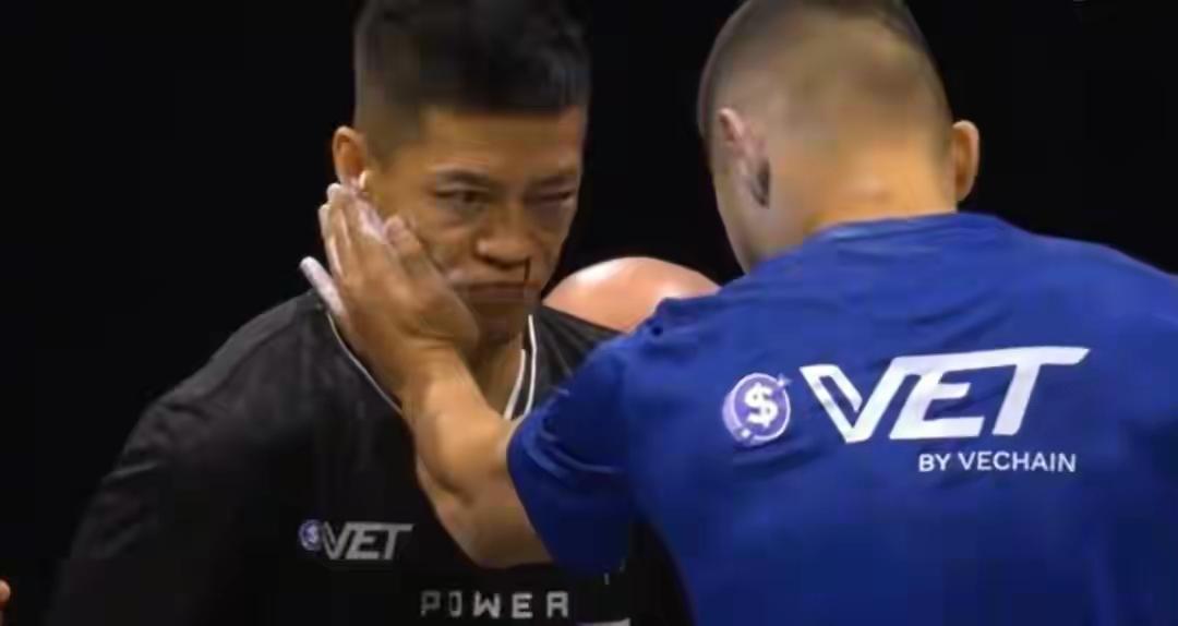 日前，中国选手赵鸿刚参加世界扇耳光大赛，最终败给对手阿曼塔耶夫。据报道，比赛视频