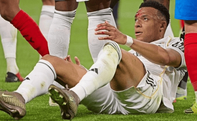 科贝：姆巴佩虽然不适缺席今天训练，但踢拜仁一定可以出场