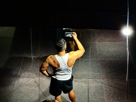 人到中年哪有不秃顶👨‍🦲