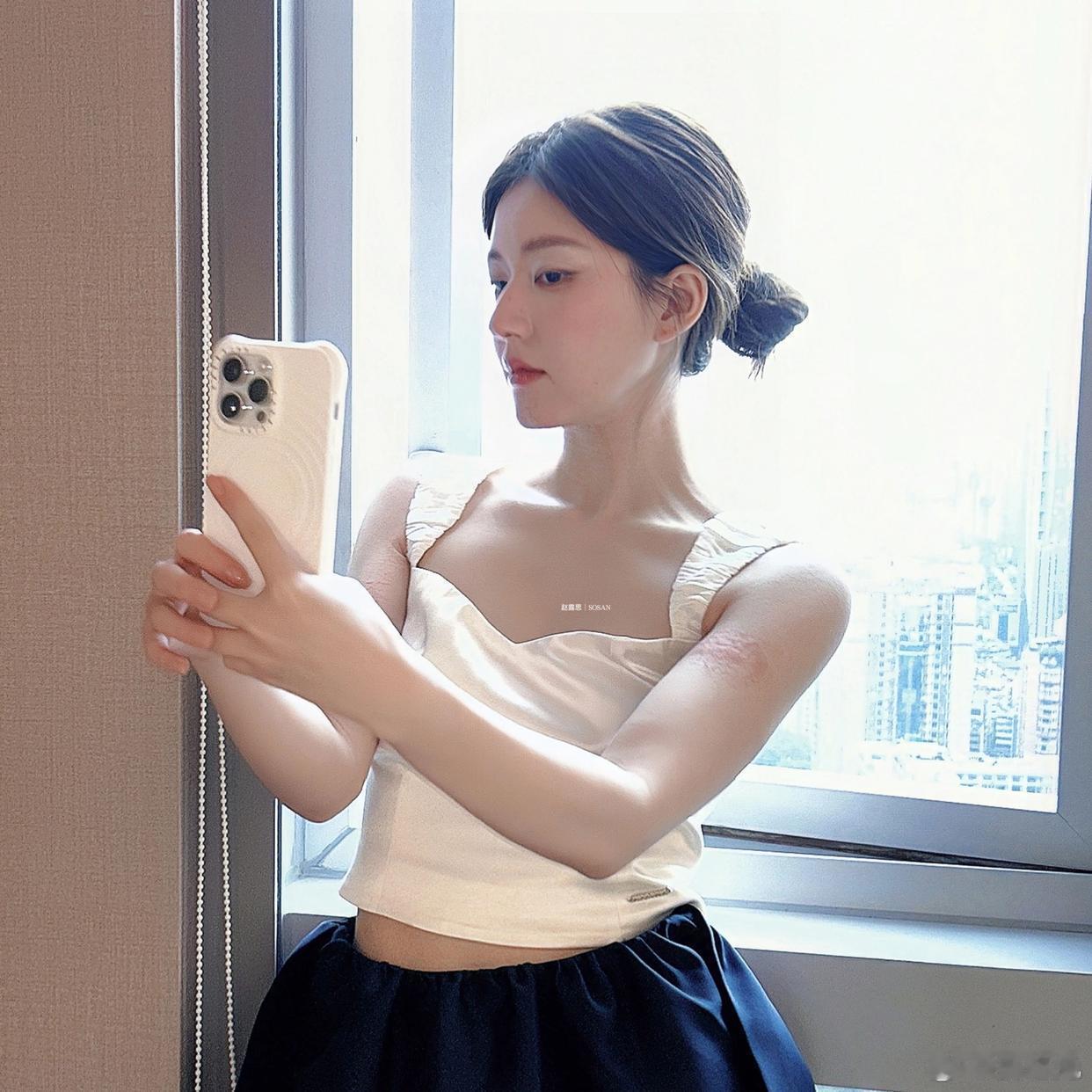 赵露思动不动过敏长寻麻疹，以后只要脸一肿粉丝就能拿过敏当借口[允悲] ​​​