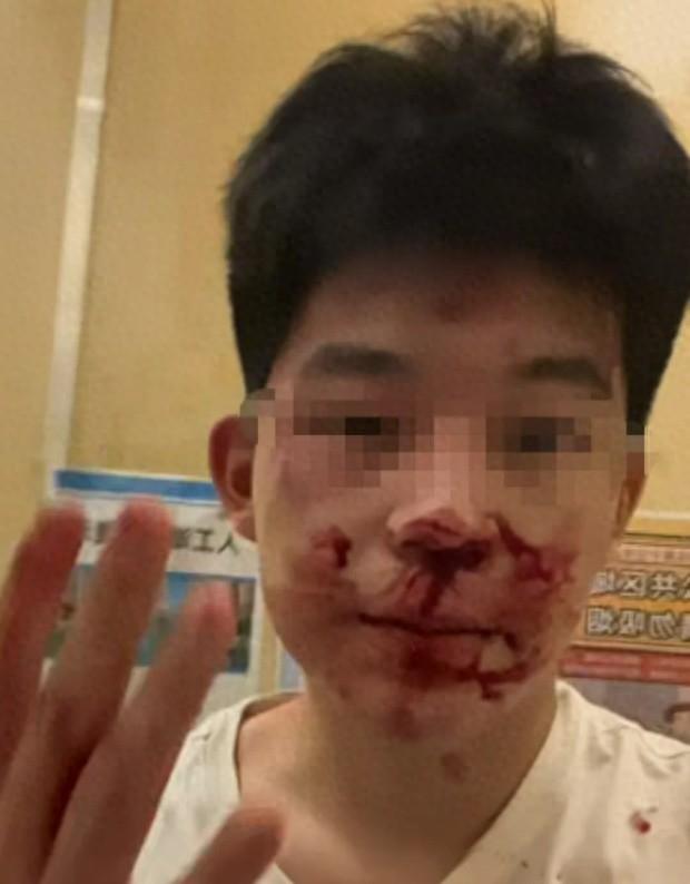 冒充民警打人者拘12天，借高考名义提前释放，22万买受害者闭嘴！民警子女就能肆意